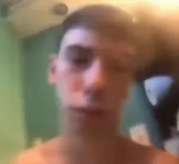 He had severe diarrhea