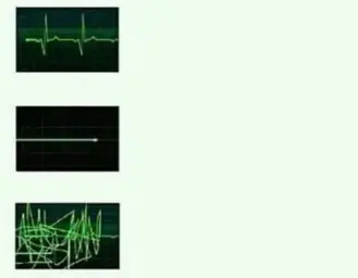 Heartbeat