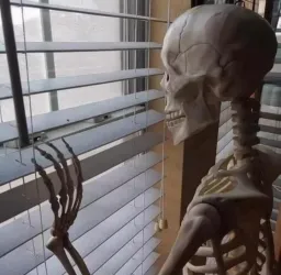 واکنش اسکلت ناراحت