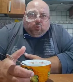 باد معده مرد کچل