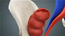 واکنش صادقانه کلیه