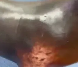 باد گلوی فوک