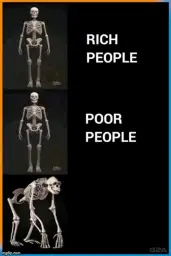 Abnormal human skeleton