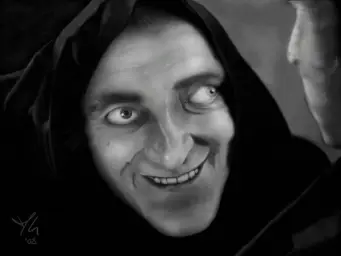 Marty Feldman extropia eyes