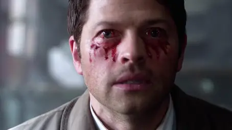 Supernatural eye bleed