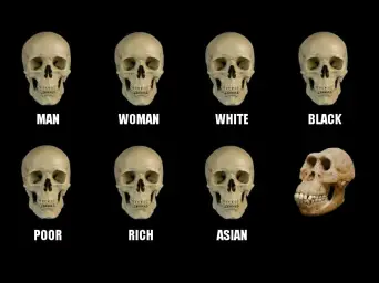 Skull Comparison